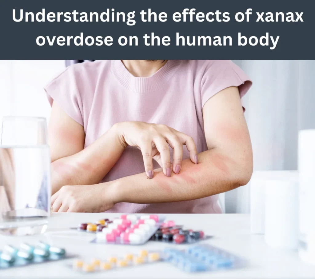 Xanax overdose